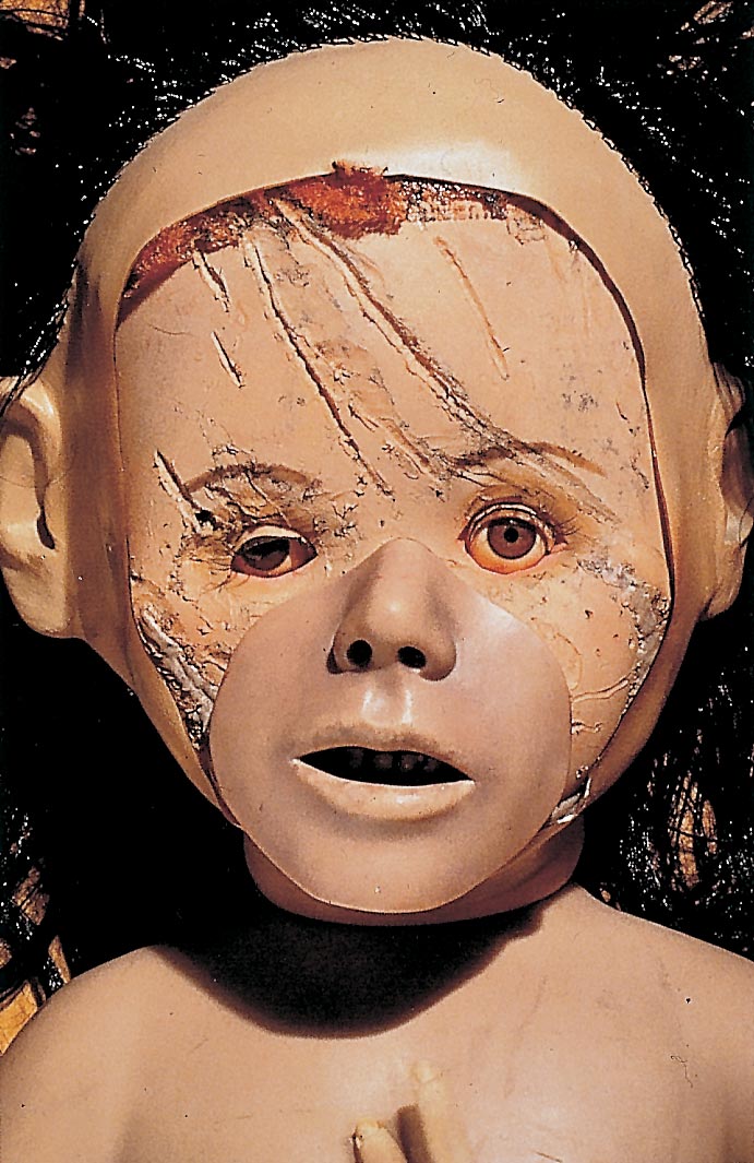 Helnwein Child: Cindy Sherman